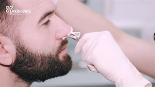 استرس قبل از عمل بینی | تکین فارمد