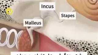 گوش و هندزفری