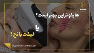 هایفو بهتر است یا لیفت با نخ؟ (تفاوت هایفوتراپی و لیفت با نخ)