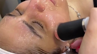 جوانسازی پوست در کلینیک آوینا لیپوست