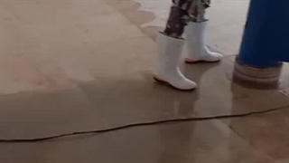 از بین بردن لکه آبلیمو پروتز دندان