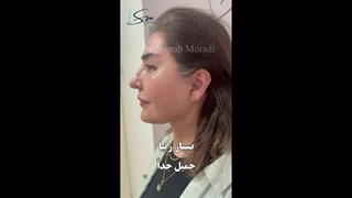 جراحة شد الوجه والرقبة