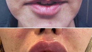 دکتر مریم خباز زاده دندان مصنوعی