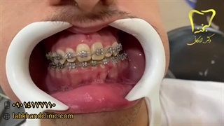 ارتودنسی در کلینیک لبخند