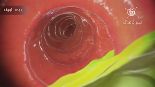 دستگاه گوارش بدن ما چگونه غذا را به مدفوع تبدیل میکند