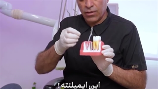 افتادن ایمپلنت یا پیج ایمپلنت