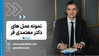 نظرات در مورد دکتر جلال معتمدی فر + نمونه کار عمل بینی در مشهد | پزشک 24
